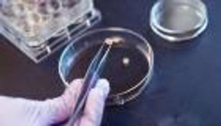 غضروف مُصمم هندسيا لعلاج هشاشة العظام