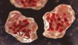 بزيادة 45 ضعفا.. الحصبة تجتاح أوروبا و«الصحة العالمية» تحذر