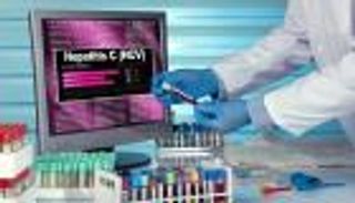 ما هي أنواع تحليل فيروس سي (HCV).. وهل يجب الصيام قبل الفحص؟