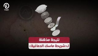 نتيجة مذهلة لـ«شريحة ماسك» الدماغية