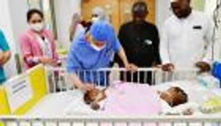 عملية فصل التوأم «حسنة وحسينة» بالسعودية.. 14 ساعة لتحقيق المعجزة (فيديو)