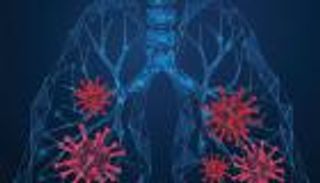 الذكاء الاصطناعي يكتشف كورونا بدقة عالية