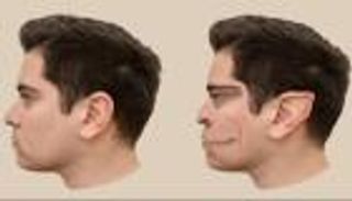 مرض نادر يشوه رؤية رجل.. ويُظهر له «الشياطين»