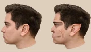 مرض نادر يشوّه وجوه البشر