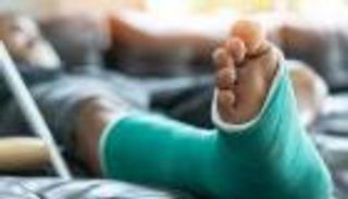 دراسة إماراتية تكشف نتائج واعدة في تعزيز تجديد العظام وعلاج الكسور