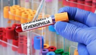 اختبار إيجابي لمريض بالهيموفيليا 