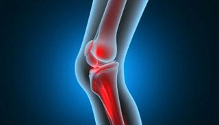 تشعيع البلازما.. تقنية جديدة لعلاج كسور العظام