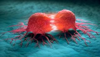 طفرة في الاكتشاف المبكر للسرطان بدعم الذكاء الاصطناعي- أرشيفية