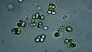 لأول مرة منذ مليار سنة.. اندماج كائنين في جسم حي واحد