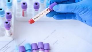 نتائج إيجابية لمصاب بمرض زومبي الغزلان