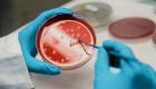 &laquo;أكثر أمانا وفاعلية&raquo;.. طفرة جديدة في علاجات الخلايا الجذعية