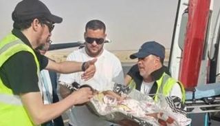  التوأم السيامي بالجزائر