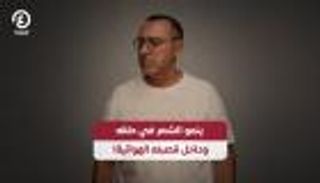 بسبب التدخين.. ينمو الشعر فى حلقه وقصبته الهوائية