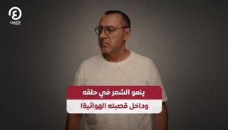 رجل نمساوي يعاني من حالة نادرة