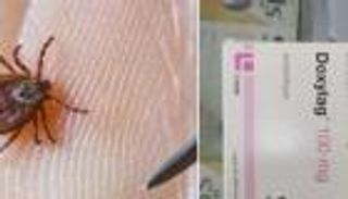 غيبوبة دامت 19 يوما.. «قرادة» تقتل فتاة أردنية