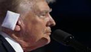 ترامب يرد على مزاعم تشكك بإصابته برصاصة في أذنه