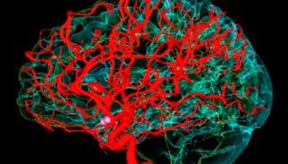 هياكل الأوعية الدموية تتدهور مع تقدم العمر