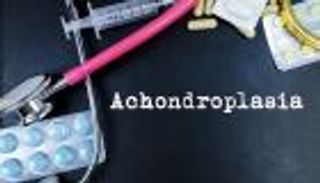 متلازمة الودانة (تشوهات هيكلية موروثة).. ما هي أعراضها وكيفية تشخيصها؟