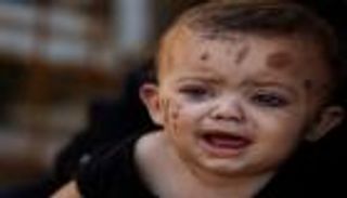 ريم.. رضيعة «تنقذ» سجل عائلة من الاندثار في خان يونس (صور)