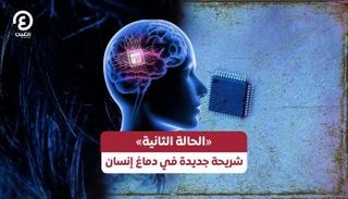 شريحة جديدة في دماغ إنسان