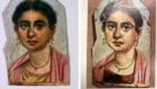 حيرة بسبب «بورترية» مومياء مصرية.. هل عانت صاحبته من ورم عصبي بالعين؟