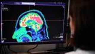 ما علاقة الهاتف المحمول بسرطان المخ؟ دراسة جديدة تحسم الجدل