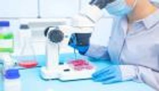 مقاومة المضادات الحيوية.. خطر يهدد حياة الملايين سنويًا بحلول 2050