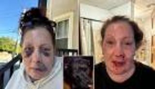 كلب وفي ينقذ حياة صاحبته.. تعرضت لاعتداء وحشي في منزلها