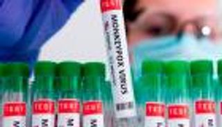 سلالة جدري القرود الجديدة تصل فرنسا.. ما خطورتها؟