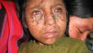 مصاصو الدماء والزومبي والمستذئبون.. حقيقة وليست خيالاً