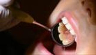 يعالج المرضى في الشوارع.. طبيب أسنان يثير جدلا واسعا بدمشق