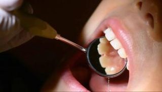 طب الأسنان- أرشيفية