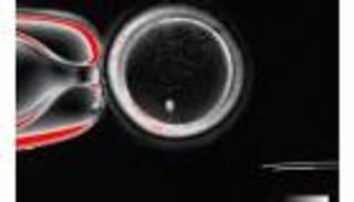 اختراق علمي.. إنتاج بويضات بشرية من خلايا الجلد لعلاج العقم