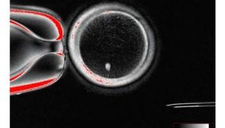 إنتاج بويضات بشرية من خلايا الجلد