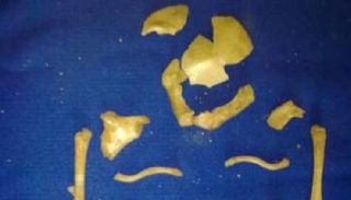 البقايا الهيكلية للجنين