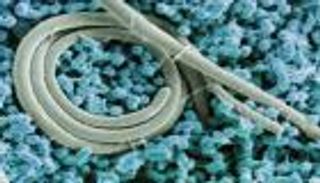 إنجاز تاريخي.. لقاح واحد يحمي من التيفوئيد والسالمونيلا