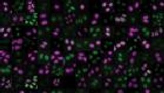 يمهد لعلاجات للسرطان.. «منظم مرور» داخل الخلية يحمي الحمض النووي