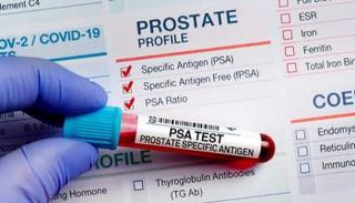 علماء يدعون لإجراء فحوص دم سنوية للرجال 