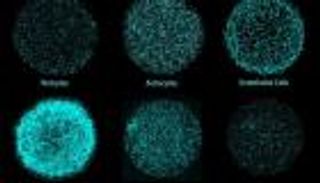 إنجاز غير مسبوق.. ابتكار أدمغة صغيرة في المختبر لتطوير أدوية أكثر دقة