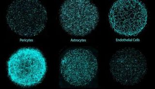 علماء يصنعون أدمغة صغيرة في المختبر لتطوير أدوية أكثر دقة