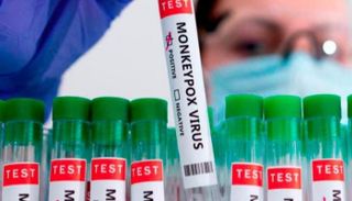 لقاح جدري القردة - أرشيفية