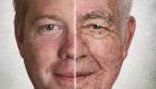 علماء يعيدون شباب الجلد.. خطوة واعدة لعلاج شيخوخة البشرة