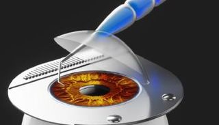 جراحة عيون- أرشيفية