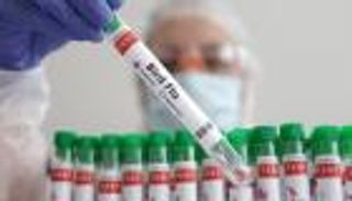 هل تسبب إنفلونزا الطيور «عدوى صامتة» لدى البشر؟