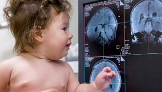 الرضع الذين يولدون بعمى مبكر في كلتا العينين يمكنهم استعادة الرؤية