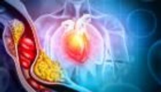 دواء جديد يخفض الكوليسترول «الضار» بنسبة تصل إلى 60% 