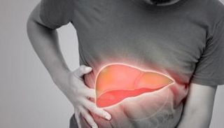 أمراض الكبد - تعبيرية