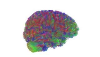 علماء كامبريدج يحددون خمس مراحل يمر بها الدماغ