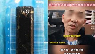 رجل يبتلع ولاعة