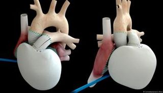 القلب الاصطناعي